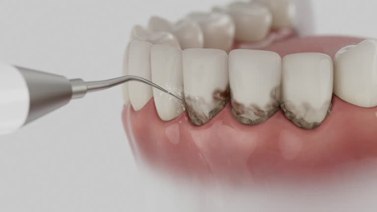 Reliable Dental contractor in Raymond, WI by Smile Center Dentistry